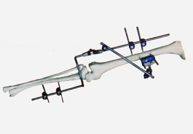 Ⅳ型2號 膝關節固定